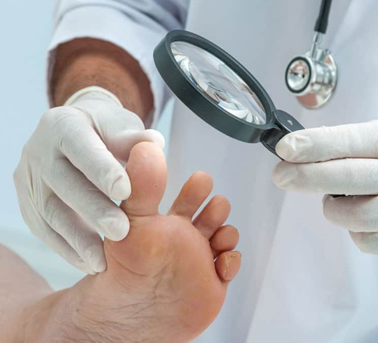 Nail Fungus Treatment